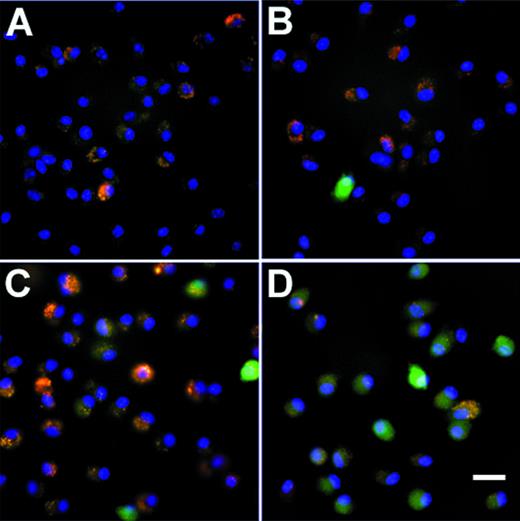 Fig. 1. GFP expression in murine alveolar macrophages in vitro. Shown is fluorescence microscopy of adherent alveolar marophages 48 hours after infection with AdGFP at various moi. Infection with AdNull is used as control. GFP fluorescence is shown in green. Nuclei are counterstained with DAPI (blue). Autofluorescent intracellular infections appear yellow-orange. (A) AdNull, 200 moi. (B) AdGFP, 10 moi. (C) AdGFP, 50 moi. (D) AdGFP, 200 moi. Bar = 50 μm.