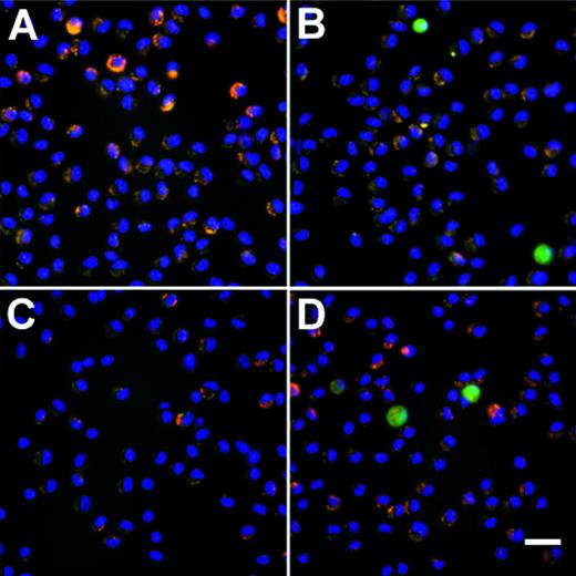 Fig. 6. Persistance of genetically modified AM after in vivo transfer of alveolar macrophages that have been modified in vitro with AdGFP or AdNull. After infection (200 moi, 90 minutes at 37°C), the cells were washed and 2 × 105 cells were transplanted to the lungs of syngeneic recipient mice via the intratracheal route. AM were recovered by lavage after 2 and 14 days, and adherent cells were evaluated by fluorescence microscopy. GFP fluorescence is shown in green. Nuclei are counterstained with DAPI (blue) and autofluorescence appears yellow-orange. (A) AM recovered 2 days after transfer of AdNull-infected cells to the lung. (B) Same as (A) but AdGFP-infected AM. (C) AdNull, 14 days. (D) AdGFP, 14 days. Bar = 50 μm. Cells recovered from naive mice showed only autofluorescence (not shown). (E) Quantitative assessment of the number of genetically modified AM. Shown is the percentage of cells expressing green fluorescence, reflecting AM expression of GFP.