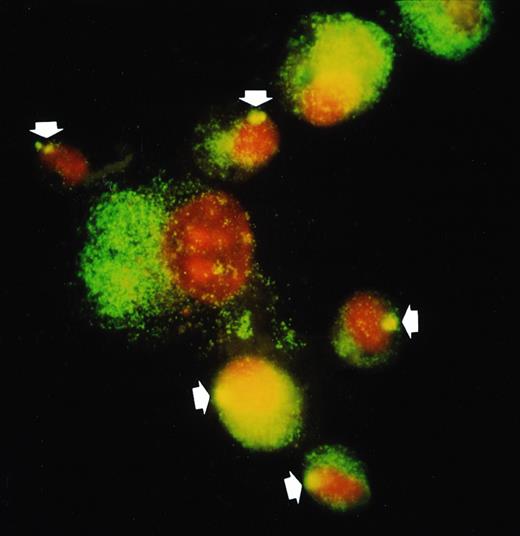 Fig. 4. FISH detection of Y-chromosome in donor AM from a recipient of sex-mismatched BMT (donor, male; recipient, female; on day 48). In situ hybridization was performed using Y-chromosome–specific cocktail probe (DYZ1/DYZ3) as described in Materials and Methods. Y chromosome is stained as a bright yellow dot in each nucleus of male AM. In the sex-mismatched BMT (1; the arrow indicates donor cell), small AM have Y chromosome (donor origin) but not with large AM (recipient origin).