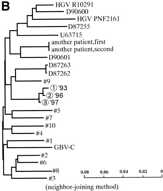 Fig. 1. (A) HGV markers and serum ALT levels of a patient (patient no. 12) with relapse of HGV viremia during chemotherapy. The patient was 14 years old at development of ALL. The horizontal line and solid bar mean years from diagnosis and periods under immunosuppressive therapy or chemotherapy, respectively. The inverted triangle indicates the timing of BMT. In the clinical course of ALT, the normal range for ALT is indicated as a horizontal line. Phylogenetic analysis was performed with the strains obtained at the timing of figures in the circle. (B) Phylogenetic analysis of different HGV isolates from the patient with reactivation of HGV infection. Figures in the circles show the strains from patient no. 12. Homology of nucleotide sequence of 312-bp E2 cDNA between reappearing and former isolates from patient no. 12 were 98% to 99%, although the homology among the other sequences was 79.8% to 88.3%. In the phylogenetic tree, HGV R10291 and PNF2164 are in the same E2 regions of the original HGV strain, and GBV-C is also in the original. We sequenced two strains derived from another patient (patient no. 15), and the strain first appearing showed just the same nucleotide sequence as the other that was obtained 2 years later. D90600, 90601, 87262, 87263, and U63715 are the accession numbers of previously reported HGV or GBV-C sequences in GenBank. Numbers 1 through 10 are strains derived from Taiwanese patients reported by Kao et al.18 (C) HGV markers and serum ALT levels of another patient (patient no. 15) with reactivation of HGV viremia during chemotherapy. Clinical courses are represented by similar notations as in (A).