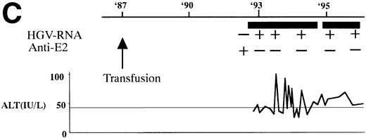 Fig. 1. (A) HGV markers and serum ALT levels of a patient (patient no. 12) with relapse of HGV viremia during chemotherapy. The patient was 14 years old at development of ALL. The horizontal line and solid bar mean years from diagnosis and periods under immunosuppressive therapy or chemotherapy, respectively. The inverted triangle indicates the timing of BMT. In the clinical course of ALT, the normal range for ALT is indicated as a horizontal line. Phylogenetic analysis was performed with the strains obtained at the timing of figures in the circle. (B) Phylogenetic analysis of different HGV isolates from the patient with reactivation of HGV infection. Figures in the circles show the strains from patient no. 12. Homology of nucleotide sequence of 312-bp E2 cDNA between reappearing and former isolates from patient no. 12 were 98% to 99%, although the homology among the other sequences was 79.8% to 88.3%. In the phylogenetic tree, HGV R10291 and PNF2164 are in the same E2 regions of the original HGV strain, and GBV-C is also in the original. We sequenced two strains derived from another patient (patient no. 15), and the strain first appearing showed just the same nucleotide sequence as the other that was obtained 2 years later. D90600, 90601, 87262, 87263, and U63715 are the accession numbers of previously reported HGV or GBV-C sequences in GenBank. Numbers 1 through 10 are strains derived from Taiwanese patients reported by Kao et al.18 (C) HGV markers and serum ALT levels of another patient (patient no. 15) with reactivation of HGV viremia during chemotherapy. Clinical courses are represented by similar notations as in (A).