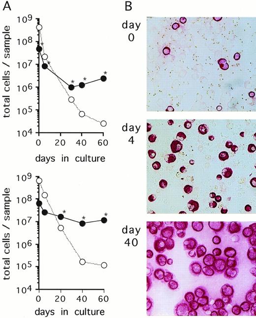 Fig. 1. Primary breast cancer cell cultures. (A) Cells contained in an ascites (upper panel) and a pleural effusion sample (lower panel) from 2 representative breast cancer patients were cultured in -MEM/10% FCS. At the indicated time points, numbers of CK-positive cells (•) and CK-negative cells (○) were determined by immunocytochemical analysis as described in Materials and Methods. At the time points indicated with an asterisk (*), detection of Ber-Ep4 was also performed yielding nearly identical cell numbers as CK-positive cells. Cultures were maintained by subcultivating total cells, ie, adherent and nonadherent fractions. (B) Immunostaining with anti-CK MoAbs of the cultures shown in the upper panel of (A) at the indicated time points (original magnification, ×100).
