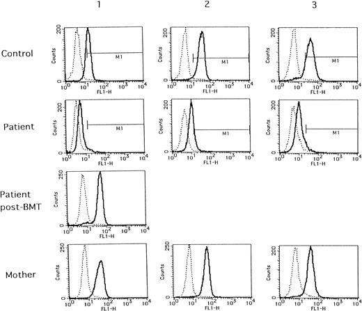 Fig. 1. Flow cytometric analysis of WASP expression in normal individuals (control), WAS patients (patient), and their mothers (mother). Blood samples from controls 1, 2, and 3 and their respective mothers were collected with the same condition as those of patients no. 1, 2, and 3, respectively. A blood sample from patient no. 1 after BMT (patient post-BMT) was collected in the separate examination.