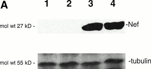 Fig. 1. Analysis of intracellular Nef protein expression in untreated or FK-treated Nef transfectants by (A) Western blot and (B) flow cytometric analyses. (A) JH6.2 (lane 1), J.Bru.2 cultured in the absence (lane 2) or presence (lane 3) of FK, and J.Bru.3 (lane 4) were subjected to Western blot analysis for Nef and tubulin. (B) Nef protein levels were determined by indirect immunofluorescence revealed by flow cytometry. Unshadowed histograms represent cells treated with anti-Nef MoAb + GAM-FITC, and shadowed histograms are negative controls (cells treated with anti-p66 of HCMV + GAM-FITC). X-axis, relative Nef expression detected by fluorescence intensity (logarithmic scale); y-axis, relative number of cells. A representative of four separate experiments is shown. The MFI (mean ± SD) of the four experiments expressed in AU was 3 ± 1 (JH6.2), 21 ± 3.5 (JBru.2), 254 ± 38 (JBru.2 + FK), and 322 ± 55 (JBru.3).