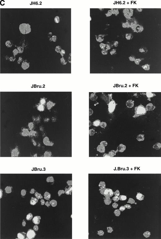 Fig. 2. Evaluation of apoptosis by (A and B) flow cytometry after PI staining and (C) indirect immunofluorescence after TUNEL in untreated or FK-treated Nef transfectants cultured for up to 24 hours in 0.1% FCS. (A) Representative experiment shows the presence of apoptosis quantitatively evaluated by flow cytometry after PI staining in 24-hour serum-starved JH6.2, J.Bru2, and J.Bru.3 cells untreated (left) or treated with 10−5 mol/L FK (right). M1, apoptotic cells; x-axis, PI fluorescence (log scale); y-axis, relative number of cells. (B) Apoptosis was quantitatively evaluated by PI staining followed by flow cytometry at different culture times. Data are the mean ± SD of four-seven separate experiments in duplicate. (C) Representative of three separate experiments in which apoptosis was evaluated by TUNEL in confocal microscopy after 24 hours of serum starvation. Apoptotic cells were identified for the presence of intense fluorescent nuclei.