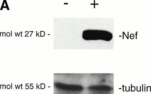 Fig. 6. Analysis of intracellular Nef protein expression in untreated or FK-treated Nef transfectants by (A) Western blot and (B) flow cytometric analyses. (A) JBru.mut.8 cells were cultured in the absence (lane 1) or presence (lane 2) of FK and then subjected to Western blot analysis for Nef and tubulin. (B) Nef protein levels were determined by indirect immunofluorescence revealed by flow cytometry. Unshadowed histograms represent cells treated with anti-Nef MoAb + GAM-FITC, and shadowed histograms are negative controls (cells treated with anti-p66 of HCMV + GAM-FITC). X-axis, relative Nef expression detected by fluorescence intensity (log scale); y-axis, relative number of cells. A representative of four separate experiments is shown. The MFI of the four experiments (AU) was 4 ± 1.5 (JBru.mut.8) and 151 ± 29 (JBru.mut.8 + FK).