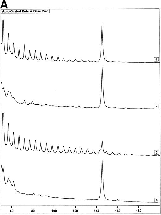 Fig. 3. Telomerase activity in PBMC from HIV-infected individuals before and after start of treatment with nucleoside analogs. (A) Representative fluorescence curves showing telomerase activity in 100,000 cell equivalents from patient 2 (Table 2). M-ITAS at 145 bp. Lane 1, before therapy; lane 2, during therapy; lanes 3 and 4, GLC4 (100 cell equivalents) and lysis buffer. (B) Telomerase activity in eight HIV-infected individuals before and after the start of treatment with nucleoside analogs. Telomerase activity was analyzed in PBMC with the semiquantitative method and expressed as percentage of activity in the GLC4 cell line. Lines connect telomerase activity before and during treatment from the same patient. Bars with error bars indicate the mean telomerase activity ± the standard deviation of the population. (C) Telomere length of PBMC from the eight HIV-infected patients at the same time points as in (B). Telomere length was analyzed by Southern blot. Telomere length is expressed as change of telomere length in kilobases over time.