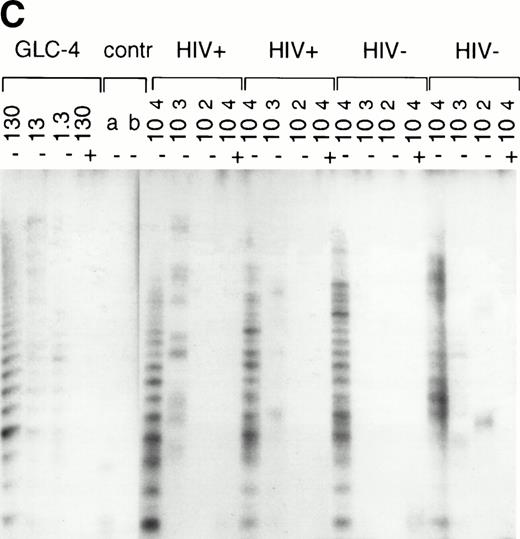 Fig. 4. Telomerase activity in lymph nodes and bone marrow from HIV-infected patients. (A) Telomerase activity in extracts equivalent to 105, 104, and 103 purified CD4+ and CD8+ T cells isolated from PB (CD4 and CD8) and lymph node tissue (LN, CD4 and CD8) shown for one representative HIV-infected individual. (B) Telomerase activity in CD4+ and CD8+ T cells isolated from PB and LN from four HIV-infected individuals, as analyzed by the original TRAP assay. (C) Telomerase activity in extracts equivalent to 104, 103, and 102 total bone marrow cells from two HIV-infected patients after AIDS diagnosis and two HIV− controls. Total bone marrow cell samples contained approximately 40% to 45% CD3+ cells, 4% CD19+ cells, and 2% CD34+ cells. In bone marrow samples from the AIDS patients, the percentage of CD4+ cells was decreased (6.5% compared with 15% in HIV− samples) and the percentage CD8+ cells was increased (30% compared with 18%).