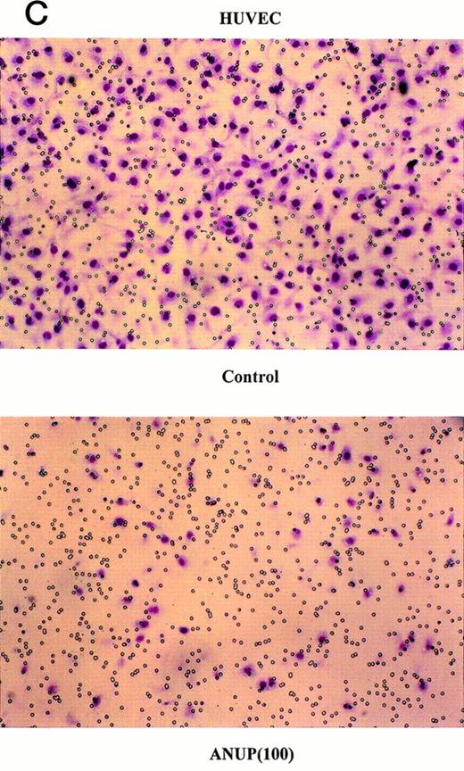 Fig. 3. ANUP inhibits KS cell migration. Migration assays were performed in double-chamber wells separated by a fibronectin-coated membrane. Chemotaxis was induced by addition bFGF (25 ng/mL) to the lower chamber. Cells (5 × 104/mL) were placed in the upper chamber in the presence and absence of test compounds. Taxol 10 ng/mL was used as a positive control. Migration of (A) endothelial cells or (B) KS cells across the membrane was quantified after overnight incubation. Representative photographs (original magnification ×360) for controls, various concentrations of ANUP, and taxol are shown for (C) endothelial cells and (D) KS Y-1 cells (see page 1039). Cells that migrated to the underside of the transwell membrane are shown; cells that did not migrate were removed from the upper surface of the membrane with a cotton swab prior to microscopy.