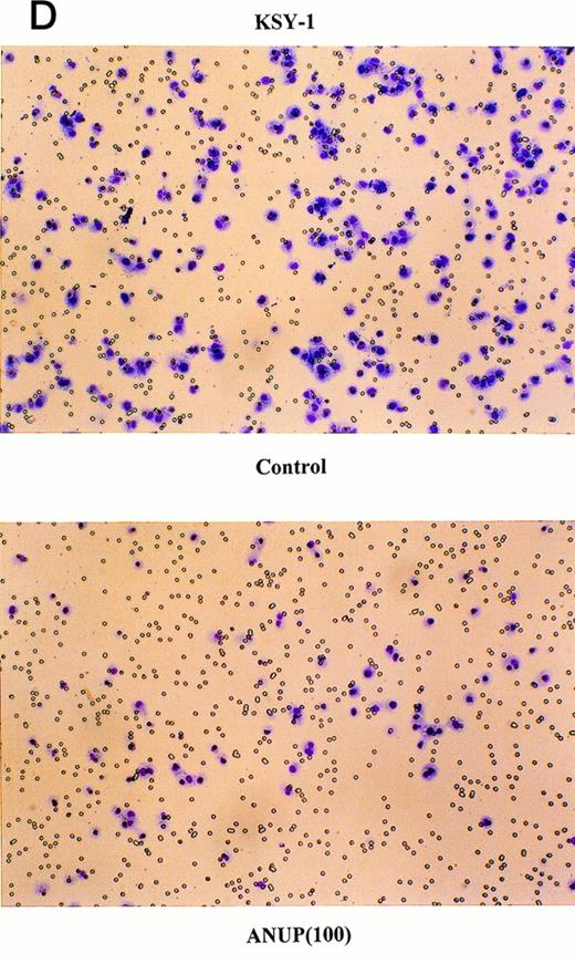 Fig. 3. ANUP inhibits KS cell migration. Migration assays were performed in double-chamber wells separated by a fibronectin-coated membrane. Chemotaxis was induced by addition bFGF (25 ng/mL) to the lower chamber. Cells (5 × 104/mL) were placed in the upper chamber in the presence and absence of test compounds. Taxol 10 ng/mL was used as a positive control. Migration of (A) endothelial cells or (B) KS cells across the membrane was quantified after overnight incubation. Representative photographs (original magnification ×360) for controls, various concentrations of ANUP, and taxol are shown for (C) endothelial cells and (D) KS Y-1 cells (see page 1039). Cells that migrated to the underside of the transwell membrane are shown; cells that did not migrate were removed from the upper surface of the membrane with a cotton swab prior to microscopy.