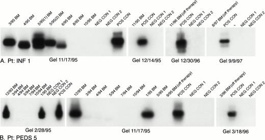 Fig. 1-1. Chemotherapy-induced elimination of MLL-AF4 positive cells in bone marrow specimens from ALL patients. (A) INF1 is an infant t(4;11) ALL case diagnosed in March 1995. (B). PEDS5 is a normal diploid ALL case diagnosed in December 1993. Sequential bone marrow specimens were analyzed for the presence of MLL-AF4 fusion transcripts using nested RT-PCR, as described. Amplified mRNA from the RS4;11 cell line was used as a positive control (POS CON). Negative controls (NEG CON) were PCR products from RNA-free and DNA-polymerase-free reaction mixtures.1-2