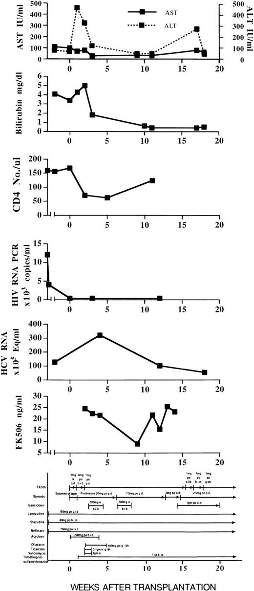 Fig. 1. Clinical course following transplantation. Liver function, HIV and HCV viral load, and antiviral treatment before and during the first 20 weeks after liver transplantation.