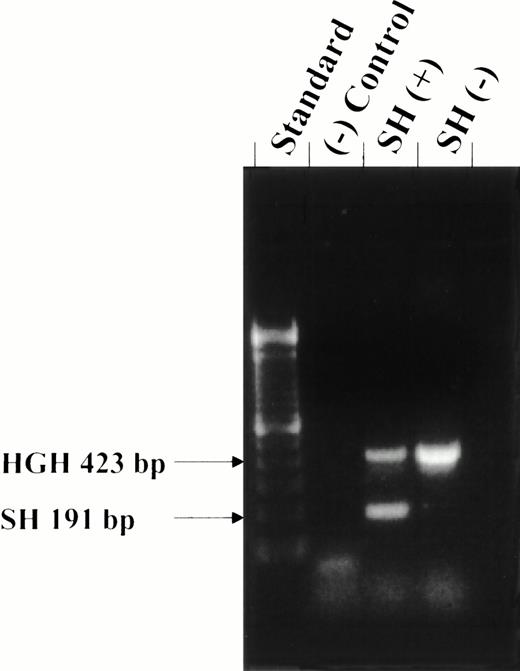 Fig. 1. SH typing by ASPCR. Twenty-five μL of each reaction was electrophoretically analyzed on a 2% ethidium bromide stained agarose gel. Lane 1, size standard; lane 2, negative control; lane 3, SH-positive sample; and lane 4, SH-negative sample.