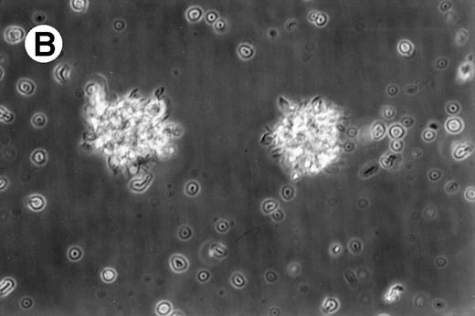 Fig. 1. Morphology of freshly isolated and cultured AML cells. Phase contrast micrographs of freshly isolated AML PBMNC (A; 100× origonal magnification); AML cells cultured for 14 days in GM-CSF, IL-4, and TNF (B; 250× original magnification); or GM-CSF, IL-4, and CD40L (C; 250× origianl magnification). (A and B) Obtained with cells from patient 13; (C) Obtained with cells from patient 18.
