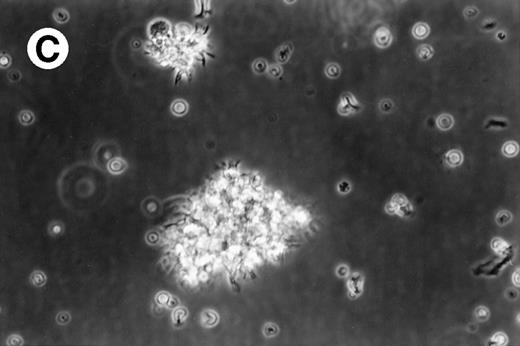 Fig. 1. Morphology of freshly isolated and cultured AML cells. Phase contrast micrographs of freshly isolated AML PBMNC (A; 100× origonal magnification); AML cells cultured for 14 days in GM-CSF, IL-4, and TNF (B; 250× original magnification); or GM-CSF, IL-4, and CD40L (C; 250× origianl magnification). (A and B) Obtained with cells from patient 13; (C) Obtained with cells from patient 18.