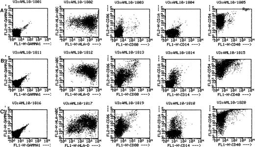 Fig. 2. AML cells cultured in the triple cytokine combinations upregulate expression of costimulatory molecules. PBMNC from AML patients were cultured in the triple cytokine cocktail for 14 days. Cells were labeled with fluorescent monoclonal antibodies and analyzed by flow cytometry. (A) Results obtained with the cells of patient 18 cultured for 14 days in Aim-V alone. (B) Cells cultured in GM-CSF, IL-4, and TNF-. (C) Cells cultured in GM-CSF, IL-4, and CD40L. Cells from patients 7 and 10 through 13 were also studied in similar experiments and comparable increases in CD1a and costimulatory molecule expression were observed.