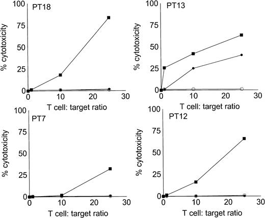 Fig. 6. Stimulation of autologous, antileukemic cytotoxicity by fresh AML cells, AML-DC cultures, and IL-2 alone. Autologous T cells were cocultured with fresh AML PBMNC, AML-DC–rich cultures, or IL-2 alone as described in Materials and Methods. They were then tested for cytotoxicity against autologous leukemia targets by LDH-release assay. Results represent the mean cytotoxicity of triplicate cultures. (▪) AML-DC–stimulated T cells, (•) fresh AML PBMNC stimulated T cells, (○) T cells cultured in IL-2 alone. Cytotoxicity of DC-AL compared with IL-2–stimulated T cells at 25:1 ratio is significant (P< .005, Student’s t-test) for each patient. Cytotoxicity of fresh AML cell-stimulated T cells compared with IL-2–stimulated T cells at 25:1 ratio is significant (P < .010, Student’st-test) for patient 13.