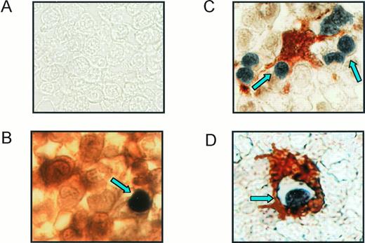 Fig. 1. Erythroblast apoptosis in normal bone marrow. Sections from bone marrow biopsies were fixed in paraformaldehyde and paraffin and double-labeled for TUNEL reaction with BCIP (black) and anti–glycophorin-A or anti-CD68 with AEC (red). (A) Control section treated with irrelevant IgG Abs and TUNEL reaction without TdT. (B) Section stained with anti–glycophorin-A and TUNEL reaction showing an immature apoptotic erythroblast (arrowhead). (C and D) Sections treated with anti-CD68 and TUNEL reaction representing macrophages surrounding and phagocytosing apoptotic cells are indicated by arrows. Representative sections from one donor out of four are shown.