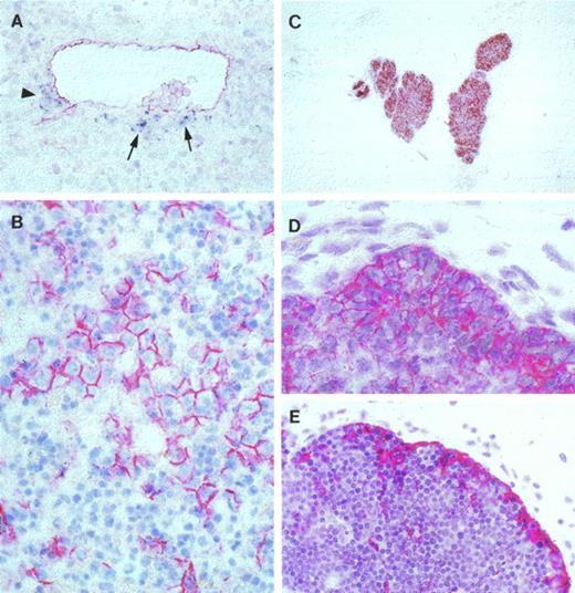 Fig. 1. HCA distribution in human embryonic and fetal blood-forming tissues. (A) Cross-section in the trunk region of a 5-week human embryo hybridized with a DIG-labeled antisense HCA probe (dark blue) and subsequently stained with the HPCA-1 antibody against the CD34 surface molecule (red). Note HCA-expressing mesenchymal cells (arrows) subjacent to a cluster of CD34+ hematopoietic progenitors associated with the ventral aortic endothelium, which also expresses CD34. A few HCA+ cells are also present on the lateral aspect of the aorta (arrowhead) (original magnification × 100). (B) Seventeen-week fetal liver. Hematopoietic cells are intermingled with polygonal hepatocytes displaying strong HCA surface staining (original magnification × 100). (C) Eight and one-half–week fetal thymus. The thymic epithelium appears uniformly stained (original magnification × 25). (D) Close-up view of an 8.5-week fetal thymus that shows stronger HCA density on epithelial cells in the outermost region of the rudiment (original magnification × 250). (E) Seventeen-week fetal thymus. Virtually all epithelial cells beneath the capsule are HCA+. Stained cells are also present within the inner cortex (original magnification × 100).