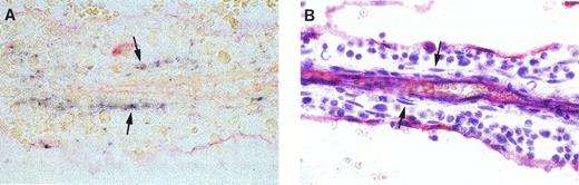 Fig. 2. In situ hybridization analysis of HCA expression in fetal BM. (A) Eleven and one-half–week fetal BM logette hybridized with a DIG-labeled HCA probe. HCA+ cells (dark blue staining) can be seen running along both sides of the central arteriole. (B) Adjacent section labeled with the same CD34 antibody as in (A) and counterstained with Gill’s hematoxylin. Endothelial cells lining the central arteriole and the primary logette express CD34. The HCA+ cells in the upper section roughly correspond to rows of flattened cells located among developing blood progenitors (arrows).