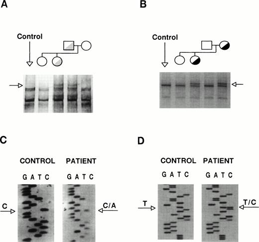 Fig. 3. Identification of the patient mutations in genomic DNA. (A) A genomic DNA fragment of 442 bp comprising exons 5 to 7 of GPIIb was PCR-amplified, digested with Taq I, denatured, and used to search for mutations by SSCP analysis, using a 16% acrylamide-8.7% glycerol gel at 14°C. (B) A 193-bp genomic DNA fragment comprising exon 21 of GPIIb was subjected to SSCP analysis in a 14% acrylamide-8.7% glycerol gel at 15°C. The arrows point to distinct bands shown by the patient and her father or mother, respectively. (C) and (D) show fragments of the sequencing ladders of the sense strands (5′ at the bottom). The arrows point to a heterozygous C to A transversion at position +2 of exon 5-intron 5 boundary of GPIIb (C) and a T to C transition in exon 21 of GPIIb (D).