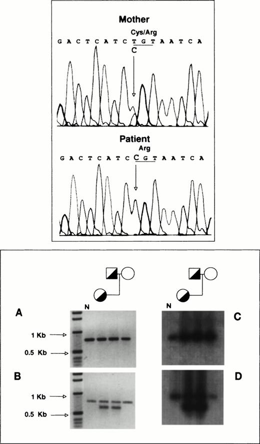 Fig. 4. RT-PCR analysis of platelet GPIIb-mRNA. (Top panel) Total RNA from the proband and her mother was reverse-transcribed and used as template for the PCR amplification of a 1,190-bp fragment encompassing exons 20 to 30 of GPIIb as described in Materials and Methods. Direct DNA sequencing of the amplification products was performed in a model ABIprism 377 DNA sequencer (Perkin-Elmer Cetus). (Bottom panel) (A) 779-bp DNA fragments encompassing exons 5 to 13 of GPIIb were amplified using as template reverse-transcribed platelet RNA as described in Materials and Methods. (B) Portions of the amplification products were reamplified using a sense primer complementary to sequences of intron 5 of GPIIb. (C) and (D) depict the hybridization analysis of the PCR products shown in (A) and (B), using a GPIIb probe lacking the oligonucleotide sequences used for amplification. N, PCR products from normal platelet RNA.