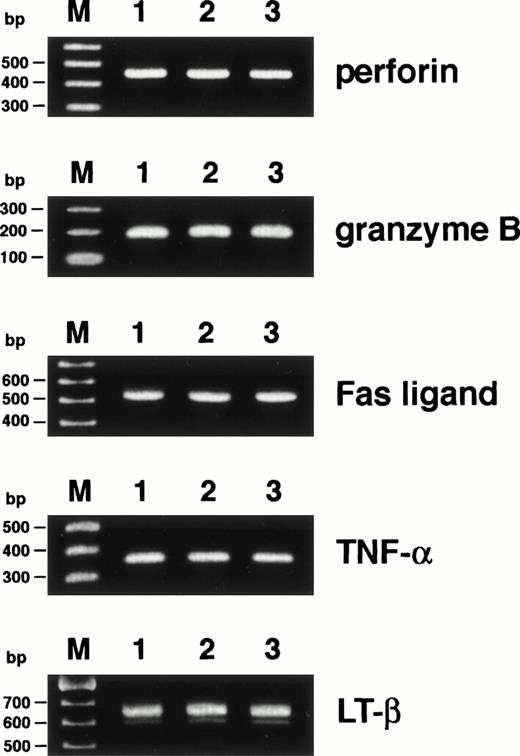 Fig. 1. Expression of cytolytic mediators in HO-1. Expression of mRNAs for perforin, granzyme B, Fas ligand, TNF-, and LT-β was investigated by RT-PCR as detailed in Materials and Methods. mRNAs were extracted from HO-1, which had been stimulated with the DEK-CAN peptide and autologous APCs for 5 days (lane 1) and for 14 days (lane 2) and from PBMCs, which had been stimulated with phytohemagglutinin for 3 days (lane 3). Lane M shows 100-bp ladder markers.