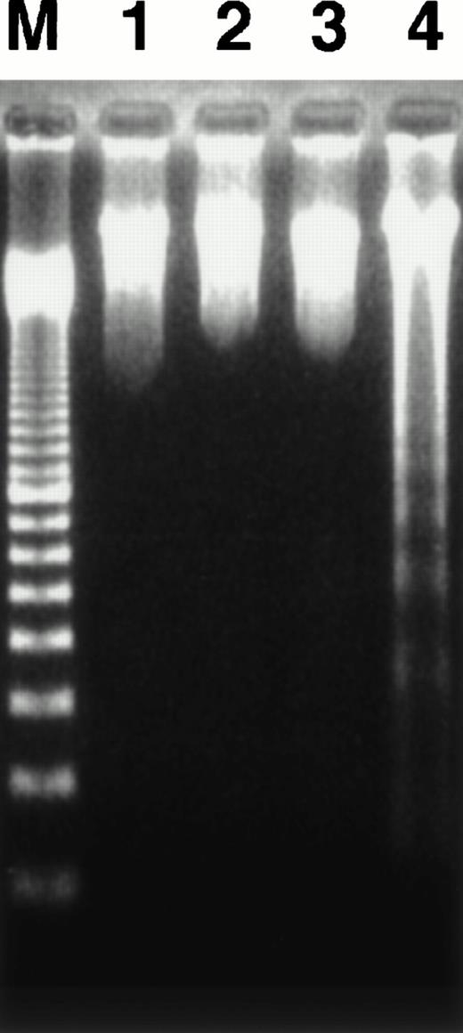 Fig. 7. Agarose gel electrophoresis of cellular DNA. HO-1 cells were cocultured with peptide-free autologous LCL (lane 1), DEK-CAN peptide-loaded autologous LCL (lane 2), or DEK-CAN peptide-loaded HLA-DR53–negative allogeneic LCL (lane 3) at an E:T ratio of 3:1 for 4 hours. The DNA was extracted from each sample and electrophoresed in 2% agarose gel. DNA extracted from B-LCL and alloantigen-specific CD8+ CTLs, which had been cocultured for 4 hours was also electrophoresed as the control for fragmented DNA (lane 4). Lane M shows 100-bp ladder markers.