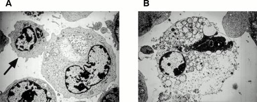 Fig. 8. Transmission electron micrographs of DEK-CAN peptide-loaded autologous LCL cocultured with HO-1. (A) A target cell, which is in contact with a CTL (arrow). Note the degeneration of the mitochondria in the target cell. (B) A target cell, which was lysed by HO-1 cells. Note the degeneration of the mitochondria and rough endoplasmic reticula in the target cell. Original magnification: (A), ×6,300; (B), ×7,200.