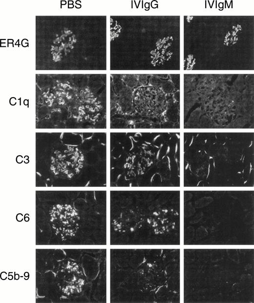 Fig. 5. Deposition of ER4G, rat C1q, C3, C6, and C5b-9 in kidney biopsy specimens. Groups of four rats each were injected IV 500 mg/kg of IVIG and 30 minutes later 0.5 mg/kg anti-Thy 1 MoAb, ER4G. Kidney biopsies were performed 10 minutes, 30 minutes, and 24 hours after ER4G injection and analyzed by immunofluorescence for the presence of ER4G and rat complement components. The extraglomerular staining observed for C3 is frequently encountered in kidney sections of adult rats and not related to the anti-Thy 1 injection. Magnification was 250:1 for all micrographs.