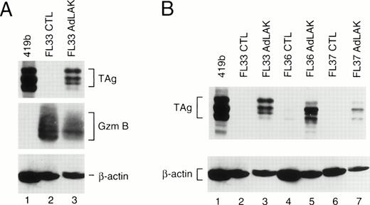 Fig. 1. (A) Western analysis of total proteins obtained from CTL or AdLAK cells from a mouse derived from founder line 33. Total protein from the positive control cell line (419b, lane 1) or from CTL or AdLAK cells from the spleen of a single mouse were cultured as described, and whole cell extracts were made. Total protein content was normalized, and SDS-PAGE was performed followed by Western analysis. The blots were first hybridized with an anti-TAg antibody, stripped, and then rehybridized with antibodies against murine granzyme B and then β-actin. CTL from the spleen of this mouse contains abundant granzyme B, but no detectable TAg; AdLAK cells contain granzyme B and TAg. (B) An analysis similar to that performed in (A) is shown, but with mice from three independent founder lines, as designated.