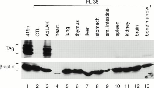 Fig. 3. Western analysis of total proteins extracted from the various tissues of an F1 mouse from founder line 36. CTL and AdLAK cells were generated as described in Fig 1. The same blot was probed with an anti-TAg antibody, stripped, and then rehybridized with an antimurine β-actin antibody. Note that TAg is expressed only in the AdLAK cells of this mouse.