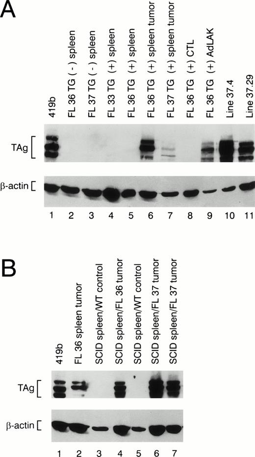 Fig. 6. Western blot analysis of protein extracts made from wild-type and transgenic mice. (A) Total protein extracts were made from nontransgenic spleens (lanes 2 and 3) or from the spleens of transgene positive mice at age 2 months (lanes 4 and 5). Extracts made from individual spleen tumors from founder lines 36 and 37 are shown in lanes 6 and 7. Extracts made from a young transgenic mouse spleen activated with ConA and 50 U/mL rhIL-2 (CTL) versus 1,000 U/mL rhIL-2 (AdLAK), are shown in lanes 8 and 9. Extracts made from tumor line 37.4 and 37.29 are shown in lanes 10 and 11. (B) Total protein extracts derived from transgenic spleens or SCID spleens injected with wild-type spleen cells or tumor spleen cells are shown. An extract obtained from a tumor spleen derived from founder line 36 is shown in lane 2. Extracts from a SCID spleens injected 8 weeks earlier with wild-type spleen cells are shown in lanes 3 and 5. An extract from a SCID spleen injected with 1 × 108 cells from a line 36 tumor spleen is shown in lane 4, and SCID spleens injected with independent tumors from founder line 37 are shown in lanes 6 and 7. Note the presence of TAg in the SCID spleens from the animals injected with granzyme H-TAg splenic tumors.