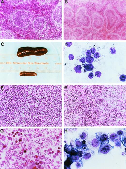 Fig. 4. Gross pathology and histopathology of transgenic mice. (A) Low power hematoxylin and eosin (H&E) stain of a spleen from a 2-month-old wild-type mouse. (B) Low power H&E stain of a spleen from a 2-month-old mouse derived from founder line 33. Note the prominent mantle zones and germinal centers in follicles. (C) Spleens from a healthy nontransgenic mouse (top) and a clinically ill transgenic mouse (bottom) from founder line 33 at the time of autopsy. Note massive enlargement of the transgenic spleen. (D) Wright’s-stained peripheral blood smear from a clinically ill mouse. At the time of autopsy, the mouse had massive hepatosplenomegaly and mesenteric lymphadenopathy. The white blood cell count at death was 156,600/μL, the hemoglobin level was 7.8 g/dL, the hematocrit was 17.7%, and the platelet count was 140,000/μL. Note the appearance of intermediate-sized, abnormal lymphocytes in the peripheral blood; ≥95% of peripheral blood cells had this appearance. (E) Low-power view of an H&E-stained section of a spleen from a mouse from founder line 33 dying with massive hepatosplenomegaly. Note the uniform appearance of large cleaved lymphocytes replacing the structure of the spleen. (F) Low-power view of a spleen from a mouse from founder line 37 dying with massive hepatosplenomegaly. Note that the tumor does not completely replace the spleen, in contrast to the spleen shown in (E). (G) High-power view of lymphocytes from a splenic tumor. Note the large cells with irregular cleaved nuclei and eosinophilic nucleoli. (H) Cell line 37.4. Note the appearance of large lymphocytes with multiple azurophilic granules, vacuolization, and large irregular nuclei. All cell lines had similar morphologic features.