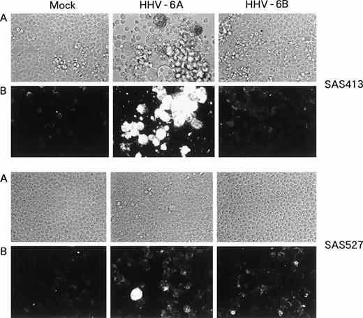 Fig. 3. Replication of HHV-6 in SAS413 and SAS527. HHV-6–inoculated SAS413 and SAS527 were observed with an inverted microscope to detect CPE (A) and analyzed by indirect immunofluorescence with HHV-6–seropositive human serum (B). Analyses were performed at day 6 of virus inoculation for HHV-6A–inoculated SAS413 and at day 240 for HHV-6B–inoculated SAS413, HHV-6A–inoculated SAS527, and HHV-6B–inoculated SAS527.