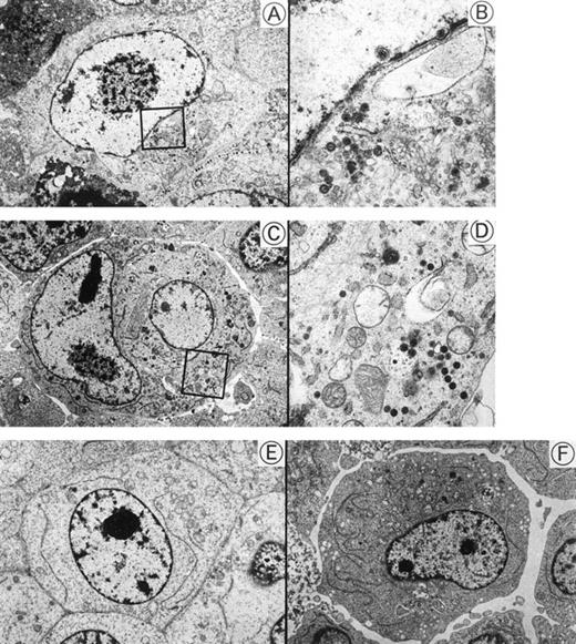 Fig. 5. Transmission electron microscopy of HHV-6–inoculated SAS413 and SAS527. Note that many HHV-6 particles are present in HHV-6A–inoculated SAS413 (A and B) and SAS527 (C and D), whereas no virus is detectable in HHV-6B–inoculated SAS413 (E) and SAS527 (F). The highly magnified boxed areas in (A) and (C) are shown in (B) and (D), respectively. HHV-6A–inoculated SAS413 cells were examined at day 6 of virus inoculation, and HHV-6B–inoculated SAS413, HHV-6A–inoculated SAS527, and HHV-6B–inoculated SAS527 cells were examined at day 240.