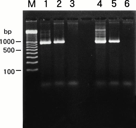 Fig. 6. Detection of HHV-6 genome in SAS413 and SAS527 by PCR. A PCR product of the expected size was detected in HHV-6A–inoculated SAS413 (lane 1), HHV-6B–inoculated SAS413 (lane 2), HHV-6A–inoculated SAS527 (lane 4), and HHV-6B–inoculated SAS527 (lane 5), but not in uninfected SAS413 (lane 3) or SAS527 (lane 6). DNA was extracted from HHV-6A–inoculated SAS413 at day 6 after virus inoculation, and from HHV-6B–inoculated SAS413, HHV-6A–inoculated SAS527, and HHV-6B–inoculated SAS527 at day 240. Lane M shows marker DNAs.