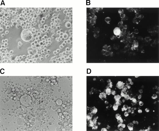 Fig. 8. Reactivation of HHV-6B in SAS527. HHV-6B–inoculated SAS527 cells were cultured in the presence of TPA at a concentration of 1.6 × 10−7 mol/L for 7 days. The cells were then observed with an inverted microscope for detection of CPE (A) and analyzed by indirect immunofluorescence with HHV-6–seropositive human serum (B). The cells were also sonicated and added to PHA-stimulated cord blood lymphocytes. After 6 days, the cells were observed with an inverted microscope for detection of CPE (C) and analyzed by indirect immunofluorescence with HHV-6–seropositive human serum (D).