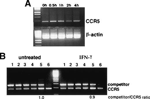 Fig. 4. (A) RT-PCR analysis of the effect of IFN-γ on CCR5 mRNA. Monocytes were incubated with IFN-γ (500 U/mL) and total cellular RNA was extracted at 30 minutes, 1 hour, 2 hours, and 4 hours after incubation with IFN-γ. (B) Competitive PCR analysis for quantification of mRNA. cDNA from the samples (untreated monocytes and monocytes incubated with IFN-γ for 30 minutes) were mixed with varying dilutions of the competitor DNA fragment and amplified with CCR5 primer sets. Lanes 1 through 6 represent increasing dilutions of competitor DNA fragment (3 × 106, 1.5 × 106, 0.7 × 106, 0.35 × 106, 3 × 105, and 3 × 104 molecules/μL). Amplification products were resolved by 4% agarose gel electrophoresis and the ratios of competitor/CCR5 DNA for untreated and IFN-γ–treated cells were determined by densitometric scanning. Lane to lane variation in RNA loading was less than 18% as assessed by densitometric analysis of β-actin expression. Representative results from 4 cord blood samples are shown.