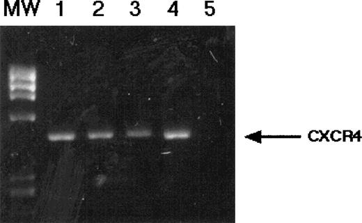 Fig. 4. RT-PCR analysis of CXCR4 mRNA expression in candidate HSC. CD34+, c-kit+, Rh123dull(lanes 1 and 2) and CD34+, c-kit+, Rh123bright (lanes 3 and 4) cells were FACS-sorted as described and subjected to RT-PCR analysis for CXCR4 mRNA. Negative control reaction (no template) is shown in lane 5. Specificity of the PCR products shown was confirmed by Southern blotting (data not shown) .