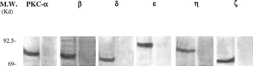 Fig. 1. Western blot analysis of PKC-, βΙ , δ, ɛ, η, and ζ isoforms in homogenates obtained from freshly isolated CD34+ cells. Isoform-specific antibodies were added to the membranes in the absence (left of each couple lanes) or presence of the corresponding immunizing peptide (right of each couple of lanes). A representative of three separate experiments is reported.
