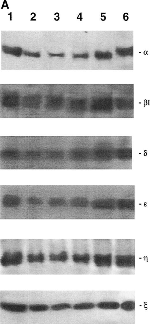 Fig. 3. Western blot analysis of PKC-, βΙ, δ, ɛ, η, and ζ isoforms in homogenates obtained from 32D (A), 32D GM1 (B), 32D G (C), and 32D Epo1 (D) cell lines. Cells were examined before (lane 1) and after 4 hours of serum-starvation (lanes 2 through 5) in the absence (lane 2) or presence of the specific growth factor that was readded for 15 (lane 3), 30 (lane 4), and 60 (lane 5) minutes. The positive control was represented by a rat brain homogenate (lane 6). A representative of five separate experiments is reported.