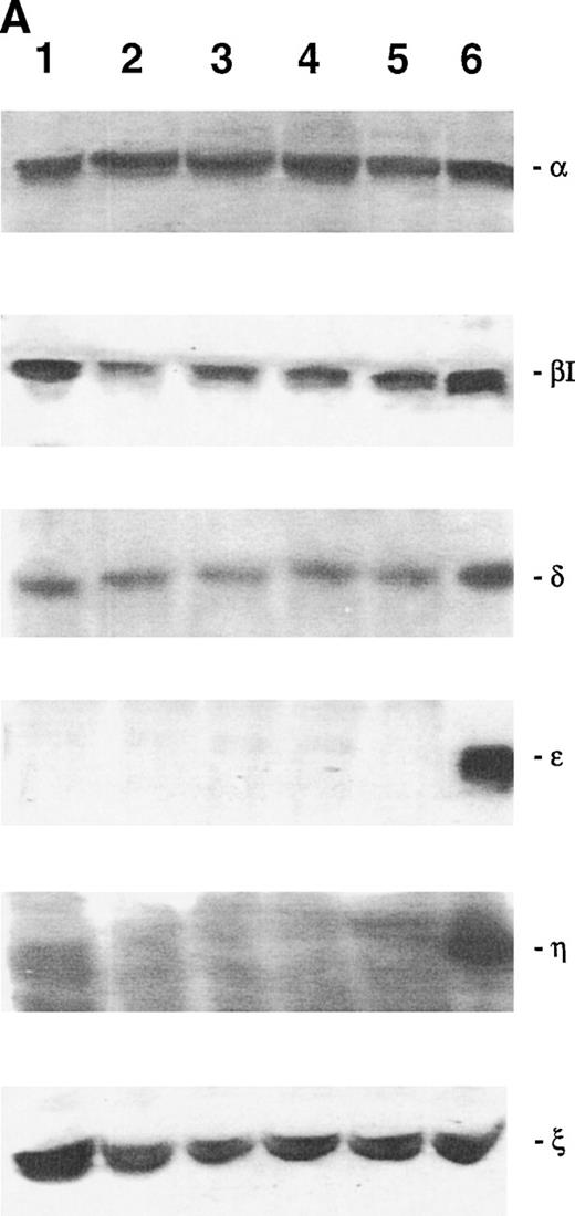 Fig. 6. Western blot analysis of PKC-, βΙ, δ, ɛ, η, and ζ isoforms in homogenates obtained from 32D Epo1.1 cells cultured in Epo (A) or IL-3 (B). Cells were examined before (lane 1) and after 4 hours of serum-starvation (lanes 2 through 5) in the absence (lane 2) or presence of the specific growth factor that was readded for 15 (lane 3), 30 (lane 4), and 60 (lane 5) minutes. The positive control was represented by a rat brain homogenate (lane 6). A representative of four separate experiments is reported.