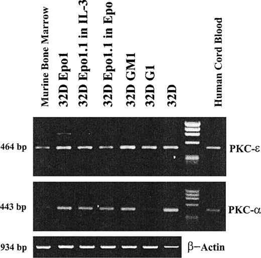 Fig. 8. RT-PCR analysis of the expression of PKC-ɛ and - mRNA in the subclones of the 32D cell lines. The ethidium bromide staining of products amplified by 30 cycles of PCR with primers specific for the PKC-ɛ and - or for murine actin and separated by electrophoresis on agarose gel are presented. Comparable amounts of products of the expected molecular weights were amplified not only from cDNA obtained from human cord blood (last lane) and mouse bone marrow (first lane) mononuclear cells, as controls, but also from cDNA obtained from all subclones of the 32D cell lines. The specificity of the PKC-ɛ band amplified from the 32D Epo cell line was proved by direct sequencing of the band eluted from the gel.
