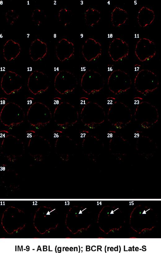 Fig. 1. Optical series obtained in IM-9 cells hybridized with gene-specific probes showing a nucleus from a late-S cell with closely associated ABL (green) and BCR (red) genes (arrows). The nuclear envelope is labeled with an anti-lamin B antibody (red).