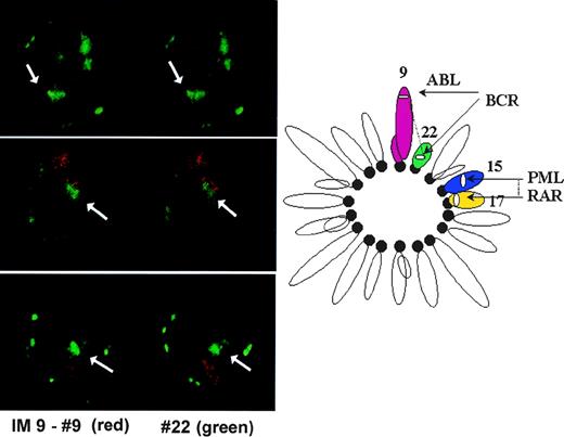 Fig. 4. Optical sections from three IM-9 cells in metaphase hybridized with painting probes for chromosomes 9 (red) and 22 (green). Note that the signal corresponding to chromosome 22 is smaller and more centrally located than that of chromosome 9. The diagram on the right represents the arrangement of chromosomes in a metaphase rosette and its potential effect on ABL-BCR and PML-RAR interdistances.
