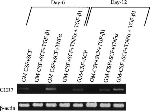 Fig. 10. The effect of TGF-β1 on the expression of E-cadherin antigen and CCR7 mRNA in cultured Lin−c-kit+ HPCs. (A) Lin−c-kit+ HPCs were cultured in the presence of various combinations of cytokines as indicated for 12 days, followed by washing twice, and were recultured in the presence of GM-CSF + TNF for an additional 3 to 5 days. These recultured cells were processed for two-color analyses by staining with a rat-antimouse E-cadherin MoAb and a PE-labeled mouse antimouse Ia and finally shown by FITC-conjugated goat-antirat IgG(Fab′)2. Histograms shown in the figures were gated on Ia+hicells. Solid and dotted lines indicate the immunofluoresecence intensity of cells stained with a control MoAb and anti–E-cadherin antigen, respectively. Representative results from three experiments are shown. (B) Examination by RT-PCR of CCR7 mRNA in Lin−c-kit+ HPCs stimulated with indicated various combinations of cytokines at day 6 or 12.