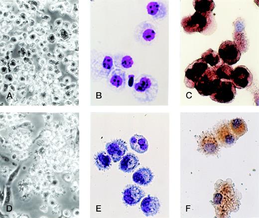 Fig. 7. TGF-β1 polarized the differentiation of murine Lin−c-kit+ HPCs into DCs through the monocyte/macrophage differentiation pathway. Murine Lin−c-kit+ HPCs were first cultured in the presence of GM-CSF + SCF for 12 days with the addition of TGF-β1 (A, B, and C). The cultured cells were then washed twice and recultured in the presence of GM-CSF + TNF for an additional 3 to 5 days (D, E, and F). (A and D) Observation by phase-contrast inverted microscope; (B and E) Giemsa-Wright staining; (C and F) NSE staining. Original magnifications: for (A) and (D) × 200; for (B), (C), (E), and (F) × 400.