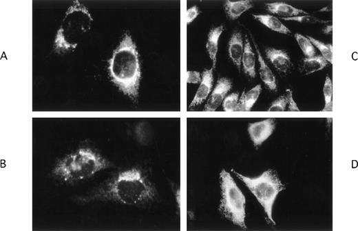 Fig. 2. Immunohistochemical localization of wild-type and mutant FVII molecules in stably transfected CHO cells. FVIIwt (A, B) and FVIICys 97 (C) were mostly localized in the perinuclear area, whereas FVIIArg100 (D) was present diffusely throughout the cytoplasm without perinuclear enhancement. Untransfected CHO cells did not react with either the anti-FVII Mab or the fluorescent second antibody indicating that the observed labeling was specific for FVII (data not shown).