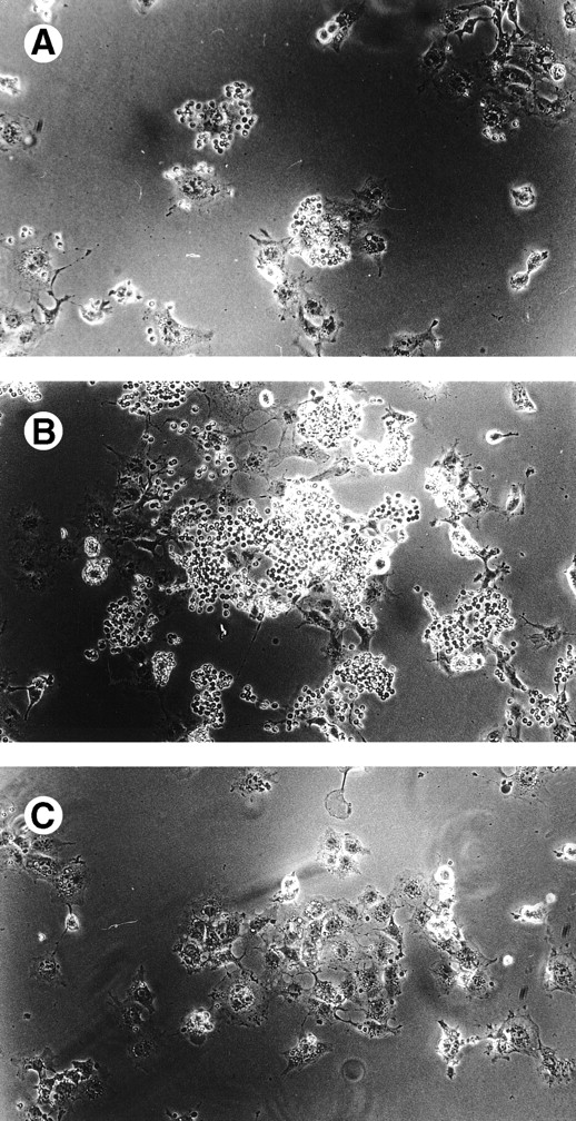 Fig. 1. Sialidase pretreatment of sialoadhesin-transfected COS cells unmasks their ability to mediate red blood cell binding. (A) Untreated sialoadhesin-transfected COS cells. (B)Vibrio Cholerae sialidase-treated sialoadhesin-transfected COS-7 cells. (C) Vibrio Cholerae sialidase-treated mock-transfected COS cells.